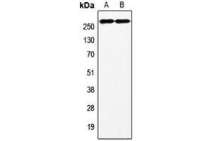 Western blot analysis of Factor VIII expression in HeLa (A), HepG2 (B) whole cell lysates.