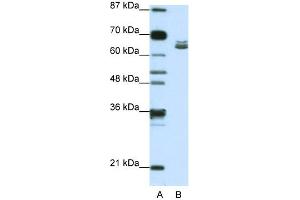 WB Suggested Anti-ZFP57 Antibody Titration:  1. (ZFP57 抗体  (N-Term))