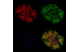 ABIN6262043 and ABIN6273250 staining Hela cells by IF/ICC.