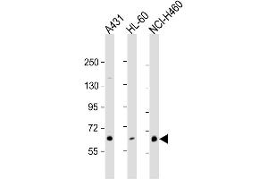 Western Blotting (WB) image for anti-Protein Kinase C, eta (PRKCH) antibody (ABIN3002933) (PKC eta 抗体)