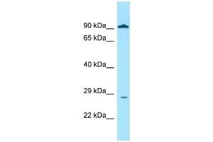 WB Suggested Anti-GLIPR1 Antibody Titration: 1. (GLIPR1 抗体  (Middle Region))