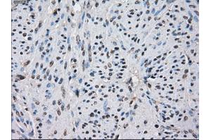 Immunohistochemical staining of paraffin-embedded colon tissue using anti-IDH1 mouse monoclonal antibody. (IDH1 抗体)