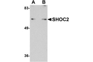 Western Blotting (WB) image for anti-Leucine-rich repeat protein SHOC-2 (SHOC2) (N-Term) antibody (ABIN1031560) (SHoc2/Sur8 抗体  (N-Term))