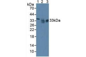 Western blot analysis of (1) Mouse Liver Tissue, (2) Human HeLa cells and (3) Human PC-3 Cells. (SIRT4 抗体  (AA 26-333))