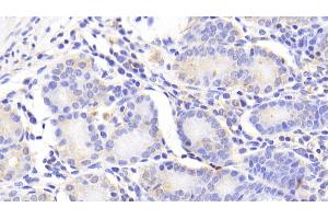 Immunohistochemistry (IHC) image for anti-Nuclear Transport Factor 2 (NUTF2) (AA 1-127) antibody (ABIN7444871)