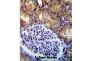 MLLT7 antibody (N-term) (ABIN390133 and ABIN2840637) immunohistochemistry analysis in formalin fixed and paraffin embedded human kidney tissue followed by peroxidase conjugation of the secondary antibody and DAB staining. (FOXO4 抗体  (N-Term))