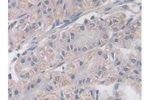 Immunohistochemistry (IHC) image for anti-Tachykinin Receptor 2 (TACR2) (AA 92-290) antibody (ABIN7432214)