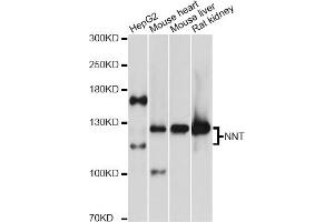 Western blot analysis of extracts of various cell lines, using NNT antibody (ABIN5972604) at 1:3000 dilution. (NNT 抗体)