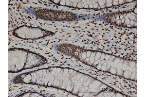 Image no. 1 for anti-CTD (Carboxy-terminal Domain, RNA Polymerase II, Polypeptide A) Phosphatase, Subunit 1 (CTDP1) (AA 332-432) antibody (ABIN599485) (CTDP1 抗体  (AA 332-432))