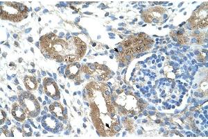 Human kidney (TRIM59 抗体  (Middle Region))