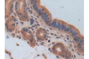 Immunohistochemistry (IHC) image for anti-Interleukin 17 Receptor A (IL17RA) (AA 590-848) antibody (ABIN7438775)