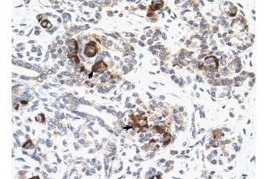 MAP2K2 antibody was used for immunohistochemistry at a concentration of 4-8 ug/ml to stain Epithelial cells of pancreatic acinus (arrows) in Human Pancreas. (MEK2 抗体  (C-Term))