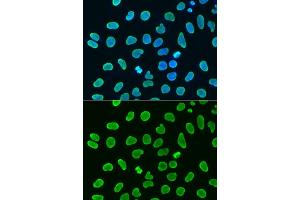 Immunohistochemistry of paraffin-embedded mouse brain using H4K8ac antibody (ABIN7267747) at dilution of 1:100 (40x lens).