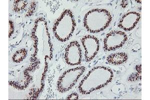 Image no. 1 for anti-Golgi Membrane Protein 1 (GOLM1) antibody (ABIN1498496) (GOLM1 抗体)
