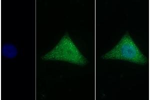 Detection of CLU in Human Hela cell using Polyclonal Antibody to Clusterin (CLU) (Clusterin 抗体  (AA 229-446))