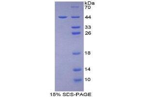 SDS-PAGE (SDS) image for CD2-Associated Protein (Cd2ap) (AA 149-429) protein (His tag) (ABIN2124276) (CD2AP Protein (AA 149-429) (His tag))