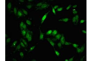 Immunofluorescent analysis of Hela cells using ABIN7160017 at dilution of 1:100 and Alexa Fluor 488-congugated AffiniPure Goat Anti-Rabbit IgG(H+L) (MAP3K11 抗体  (AA 536-693))