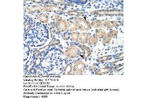 Rabbit Anti-KCBAB2 Antibody  Paraffin Embedded Tissue: Human Kidney Cellular Data: Epithelial cells of renal tubule Antibody Concentration: 4.