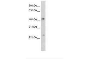 Image no. 1 for anti-Gap Junction Protein, alpha 4, 37kDa (GJA4) (AA 101-150) antibody (ABIN203512) (GJA4 抗体  (AA 101-150))