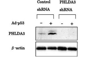 Western blotting was performed using PHLDA3 monoclonal antibody, clone 4B6  to detect PHLDA3 protein expression. (PHLDA3 抗体  (AA 1-31))