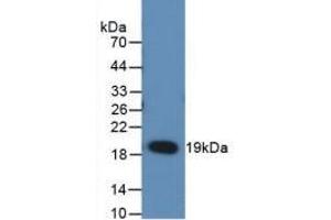 Detection of Recombinant RANkL, Rat using Monoclonal Antibody to Receptor Activator Of Nuclear Factor Kappa B Ligand (RANkL)