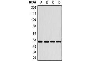 Western blot analysis of CD147 expression in A431 (A), HeLa (B), Raw264. (CD147 抗体  (C-Term))