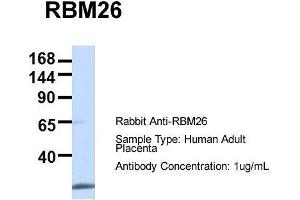 Host:  Rabbit  Target Name:  RBM26  Sample Type:  Human Adult Placenta  Antibody Dilution:  1. (RBM26 抗体  (Middle Region))