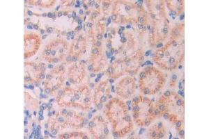 Used in DAB staining on fromalin fixed paraffin- embedded kidney tissue (Ladinin 1 抗体  (AA 1-140))