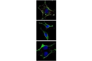 Immunofluorescence (IF) image for anti-Mast/stem Cell Growth Factor Receptor (KIT) antibody (ABIN3028783)