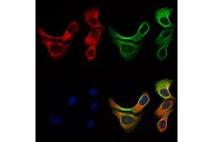 ABIN6257219 and ABIN6276016 staining Hela cells by IF/ICC. (GPR153 抗体  (Internal Region))