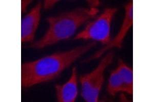 Immunofluorescence analysis of methanol-fixed HeLa cells using Phospho-SYN1(S9) Polyclonal Antibody (SYN1 抗体  (pSer9))