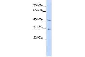 WB Suggested Anti-DHODH Antibody Titration:  0. (DHODH 抗体  (Middle Region))