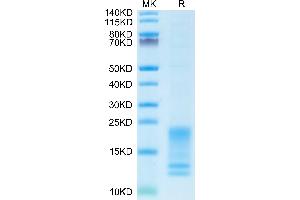 SDS-PAGE (SDS) image for Tumor Necrosis Factor Receptor Superfamily, Member 13C (TNFRSF13C) protein (His-Avi Tag,Biotin) (ABIN7273915)