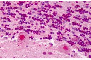 Human Brain, Cerebellum: Formalin-Fixed, Paraffin-Embedded (FFPE) (RBX1 抗体  (C-Term))
