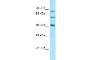 Western Blotting (WB) image for anti-Sulfatase Modifying Factor 1 (SUMF1) (N-Term) antibody (ABIN2789756) (SUMF1 抗体  (N-Term))