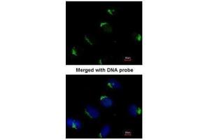 ICC/IF Image Immunofluorescence analysis of paraformaldehyde-fixed HeLa, using Bag1, antibody at 1:200 dilution. (BAG1 抗体)
