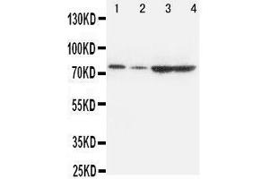 Western Blotting (WB) image for anti-Proprotein Convertase Subtilisin/kexin Type 9 (PCSK9) (AA 671-687), (C-Term) antibody (ABIN3042887) (PCSK9 抗体  (C-Term))