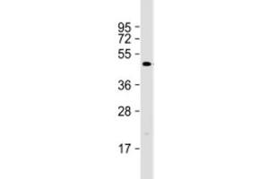 Western blot testing of human SW480 cell lysate with DEDD2 antibody at 1:1000. (DEDD2 抗体  (AA 43-75))