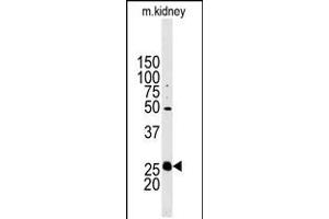 Western blot analysis of anti-STC2 Antibody in mouse kidney tissue lysates (35ug/lane). (Stanniocalcin 2 抗体  (N-Term))