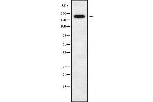 Western blot analysis of DOCK11 using K562 whole cell lysates (DOCK11 抗体  (Internal Region))