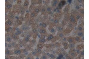 Detection of GSTt2 in Mouse Liver Tissue using Polyclonal Antibody to Glutathione S Transferase Theta 2 (GSTt2) (GSTT2 抗体  (AA 15-216))
