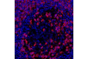 Immunofluorescence (IF) image for anti-CD45RO (CD45RO) antibody (ABIN7449553) (CD45RO 抗体)