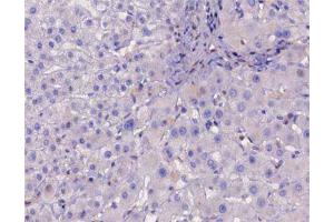 Immunohistochemistry (IHC) image for anti-Inhibitor of kappa Light Polypeptide Gene Enhancer in B-Cells, Kinase beta (IKBKB) (pTyr188) antibody (ABIN6256660)