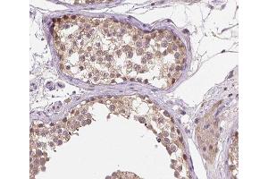 ABIN6266523 at 1/200 staining human testis tissue sections by IHC-P. (Cyclin A1 抗体  (C-Term))