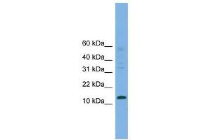 Western Blot showing CRABP2 antibody used at a concentration of 1-2 ug/ml to detect its target protein. (CRABP2 抗体  (Middle Region))