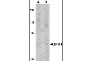 Western blot analysis of JPH1 in 293 cell lysate with this product at (A) 1 and (B) 2 μg/ml. (Junctophilin 1 抗体  (C-Term))
