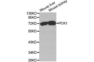Western blot analysis of extracts of various cell lines, using PCK1 antibody. (PCK1 抗体  (C-Term))