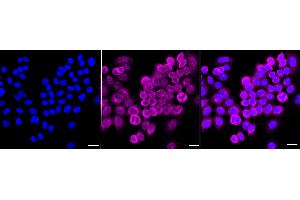 Immunocytochemical staining of HepG2 cells with NF-kB p65 antibody (ABIN7799645), 1:1,000). (Recombinant NF-kB p65 抗体)