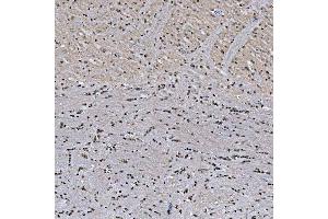 IHC analysis of SNRNP27 using anti-SNRNP27 antibody (ABIN7599614).