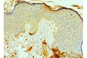Immunohistochemistry of paraffin-embedded human skin tissue using ABIN7164791 at dilution of 1:100 (FAP 抗体  (AA 26-280))